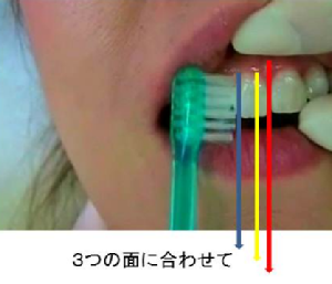 periodontal01