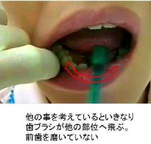 periodontal02
