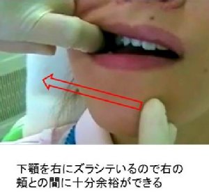 periodontal04